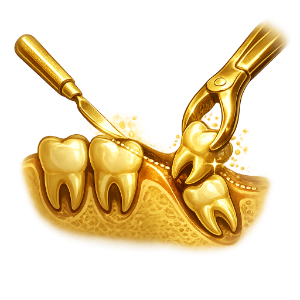 Extracción de Cordales