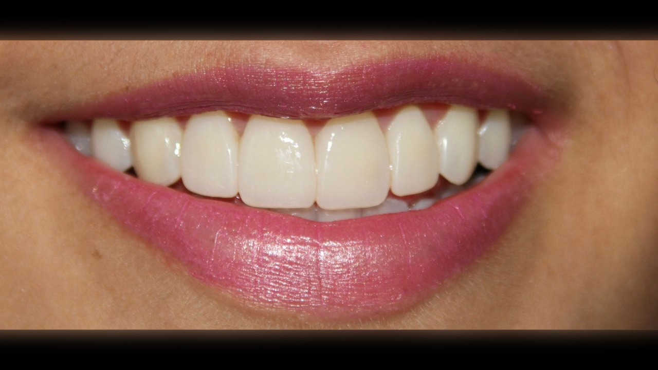 Después del tratamiento